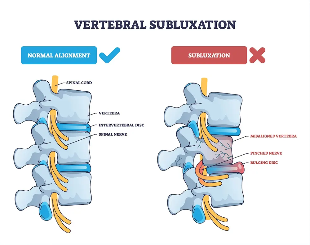 Spinal Alignment