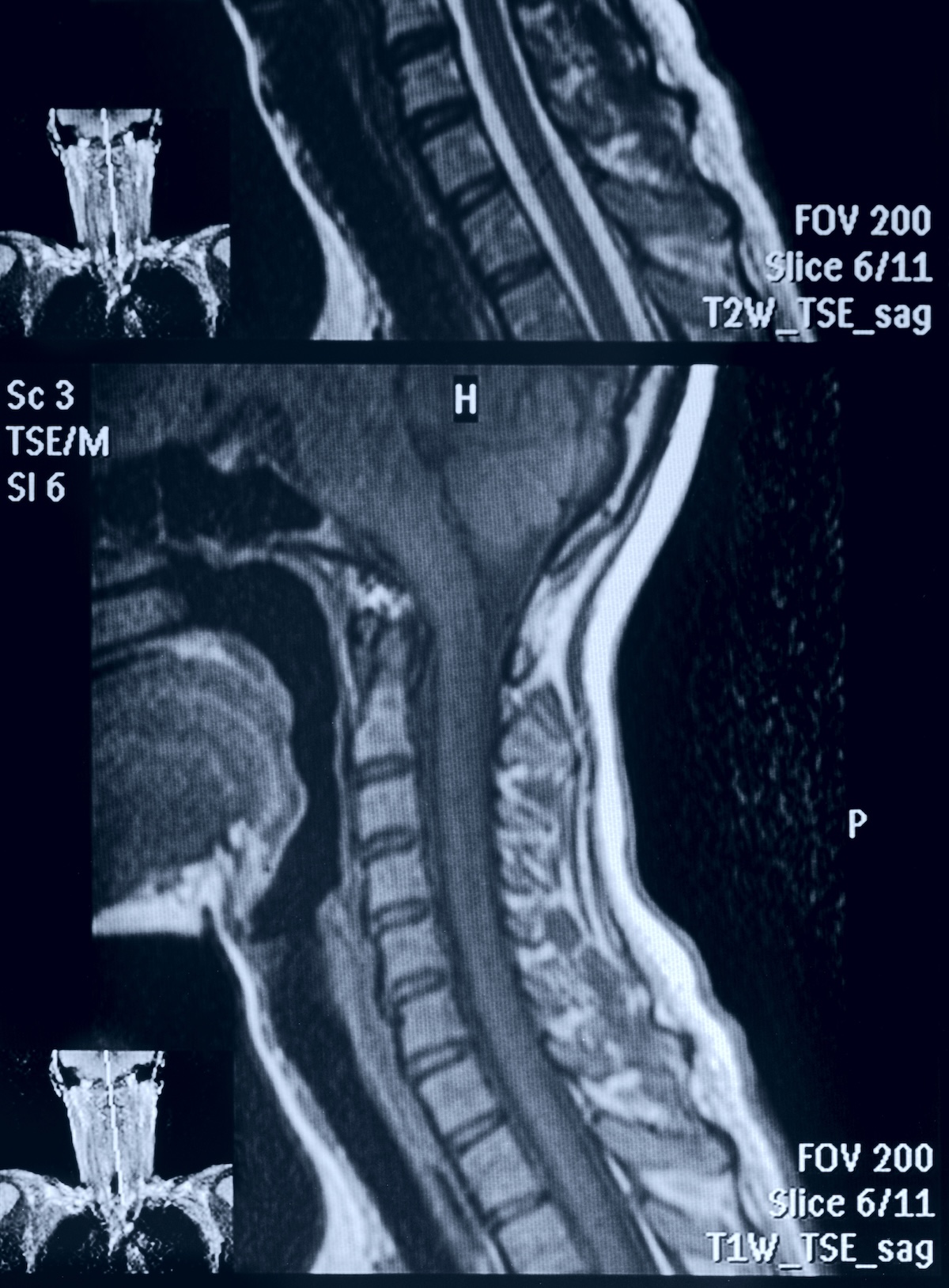 Head and neck MRI scan, no personal data Head and neck MRI scan, no personal data