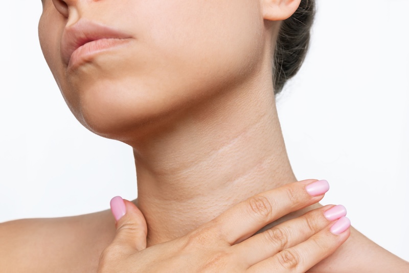 What Is the Upper Cervical Spine?
