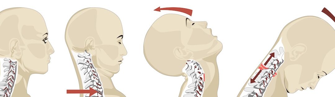 Boise Whiplash Treatment