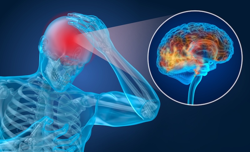 Head pain Attack, man suffering from brain pain. 3D illustration