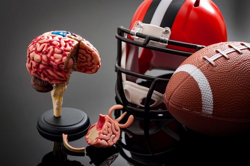 Brain damage and sports injury concept with damaged brain model, american football helmet and a ball, illustrating CTE (Chronic traumatic encephalopathy) a syndrome caused by repeated concussion