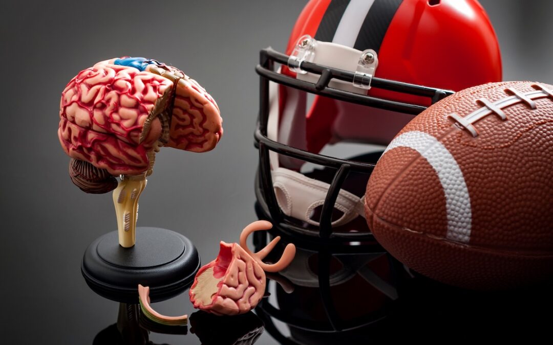 Concussion